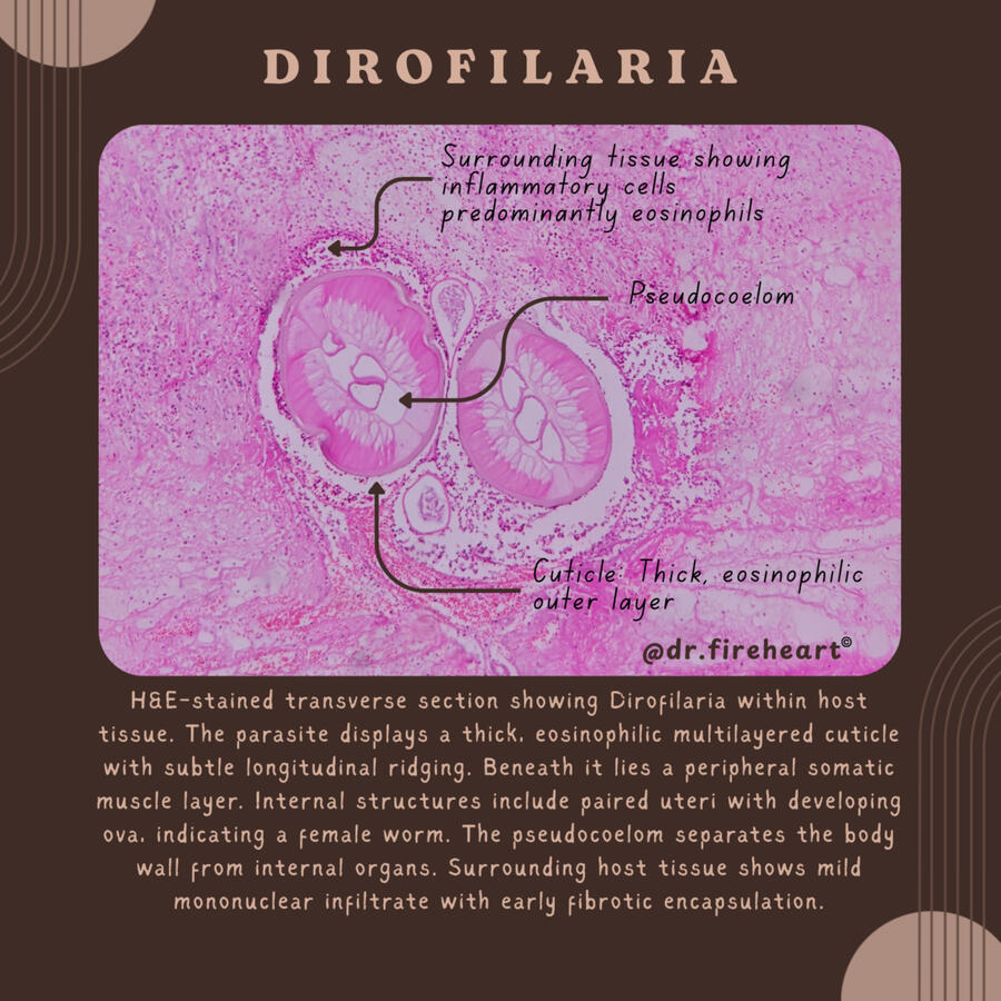 DIROFILARIA